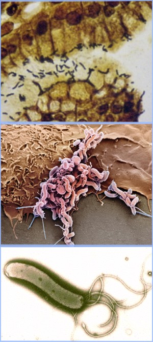Helicobacter Pylori por microscopía óptica y electrónica